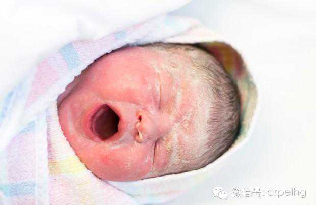 杭州代怀孕产子公司，子宫颈管粘连是什么症状