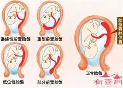 浙江女性怎样助孕,杭州试管医院排名前十名的有哪些？附详细医院情况